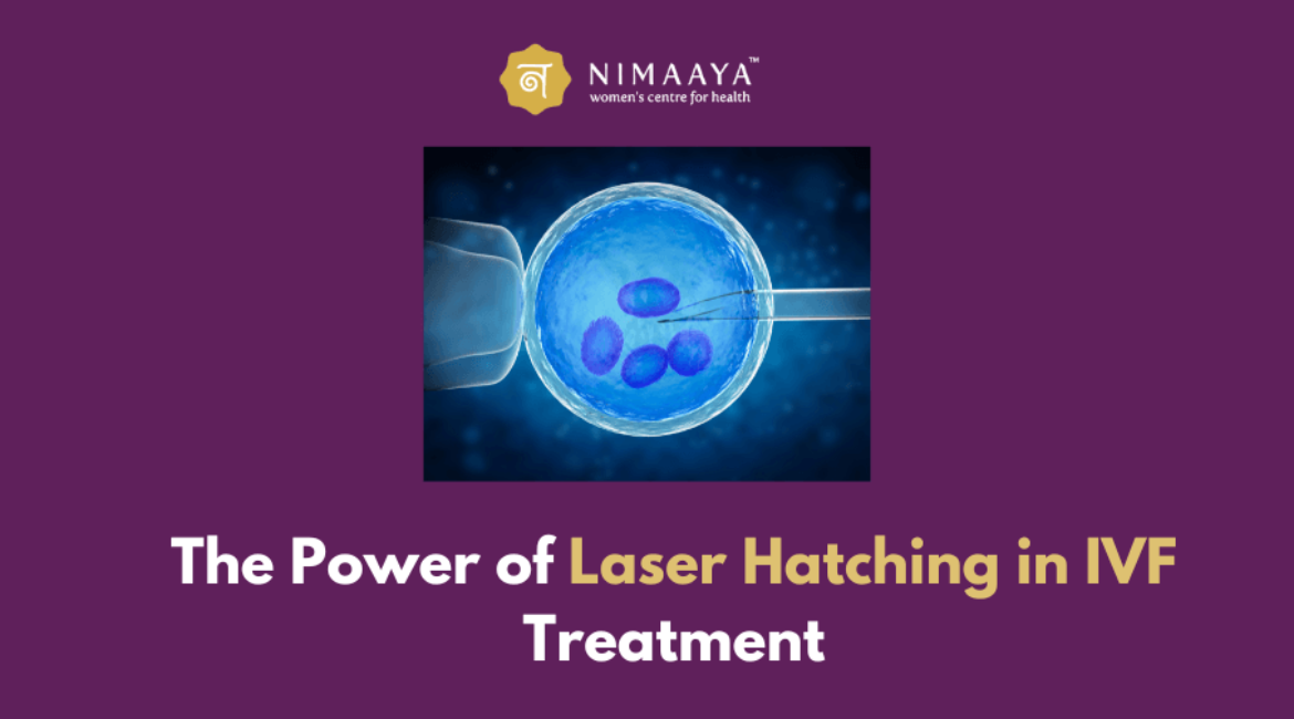 Laser Assisted Hatching in IVF: Enhancing Success rates?