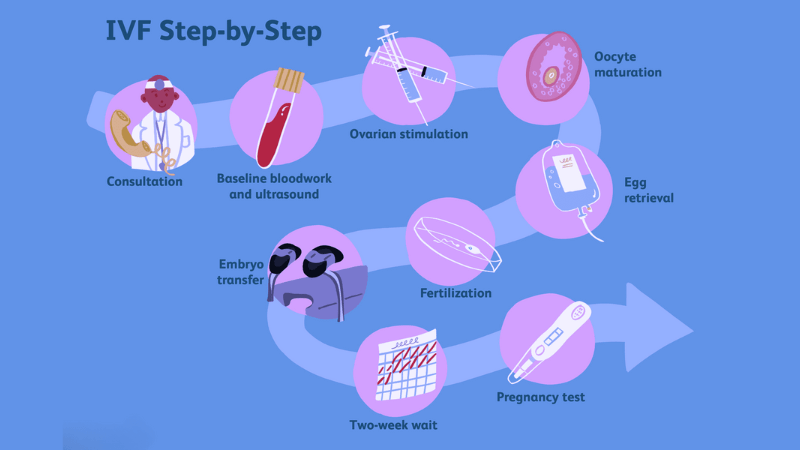 In Vitro Fertilization IVF A Comprehensive Guide