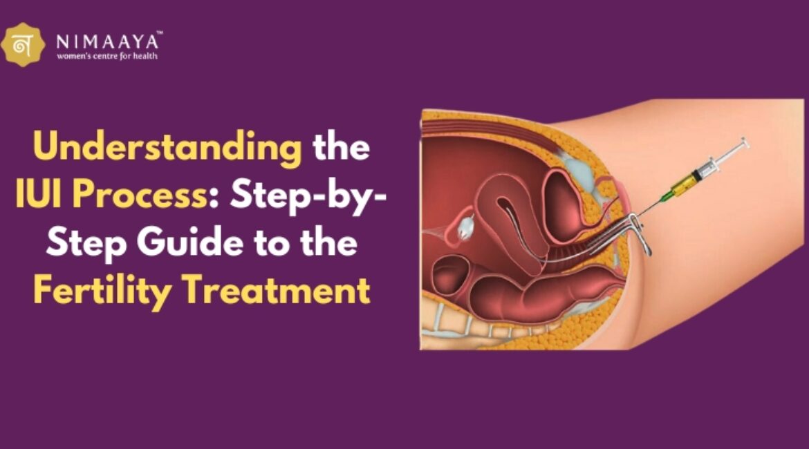 Understanding the IUI Process: Step-by-Step Guide to the Fertility Treatment