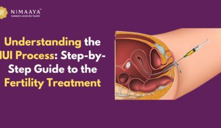 Understanding the IUI Process: Step-by-Step Guide to the Fertility Treatment