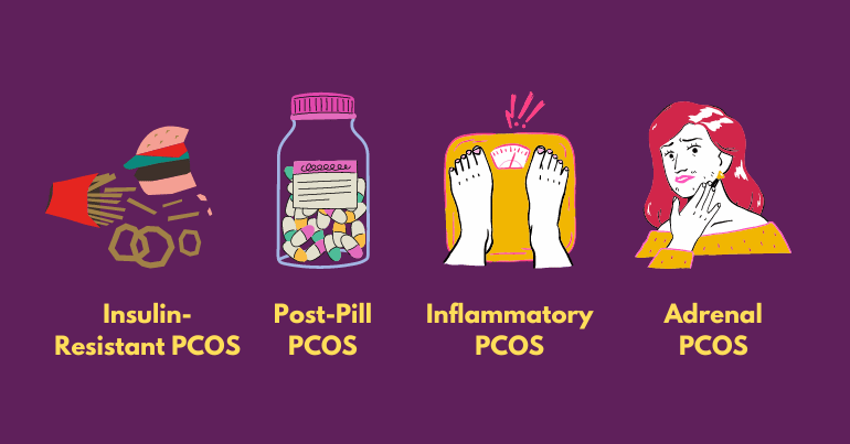 Different Types of PCOS