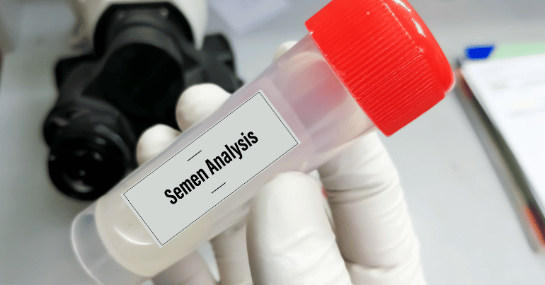 Abnormal Semen Analysis