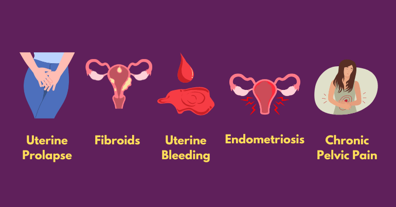 Indications for Vaginal Hysterectomy 