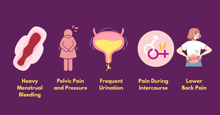 Symptoms of a Bulky Uterus