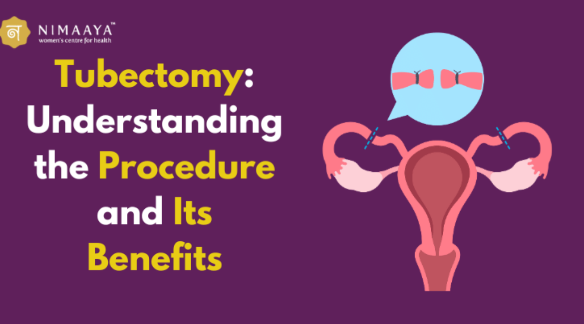 Tubectomy: Understanding the Procedure and Its Benefits