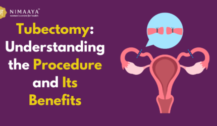 Tubectomy: Understanding the Procedure and Its Benefits