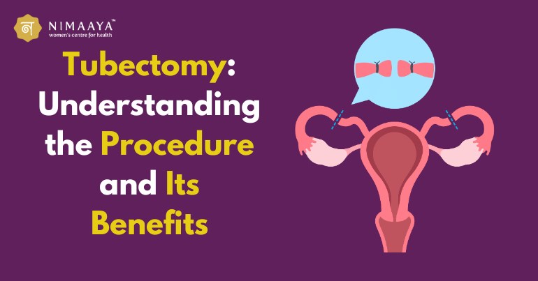 Tubectomy: Understanding the Procedure and Its Benefits