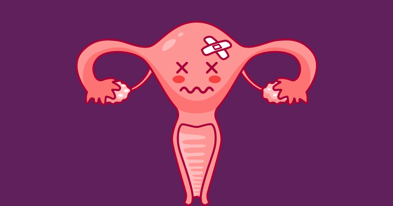 Anteverted Uterus