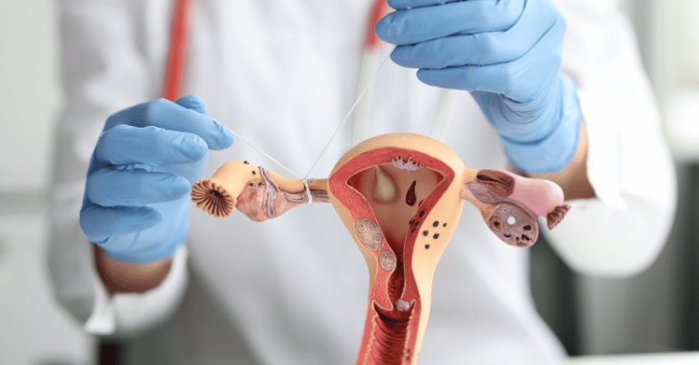 Blocked Fallopian Tubes