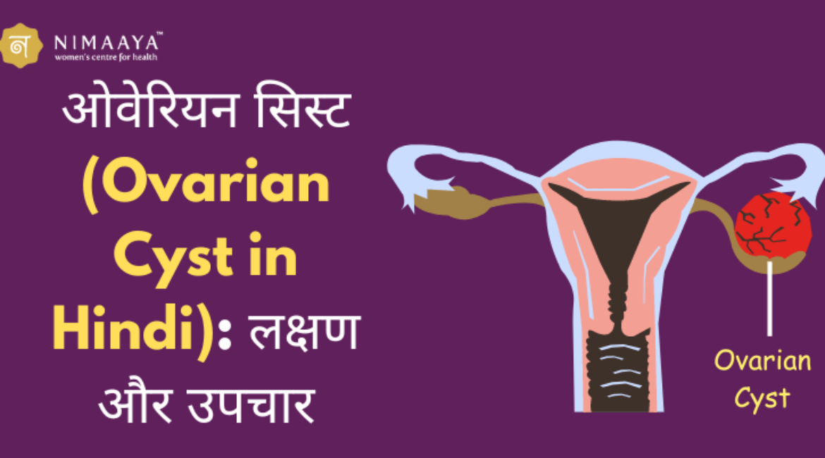 ओवेरियन सिस्ट (Ovarian Cyst in Hindi): लक्षण और उपचार