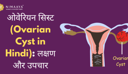 ओवेरियन सिस्ट (Ovarian Cyst in Hindi): लक्षण और उपचार