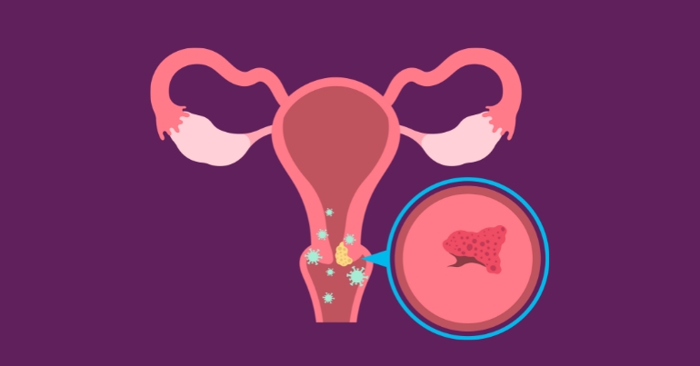 What is Cervical Mucus