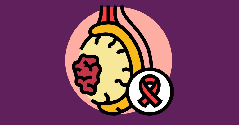 Causes of Testicular Atrophy