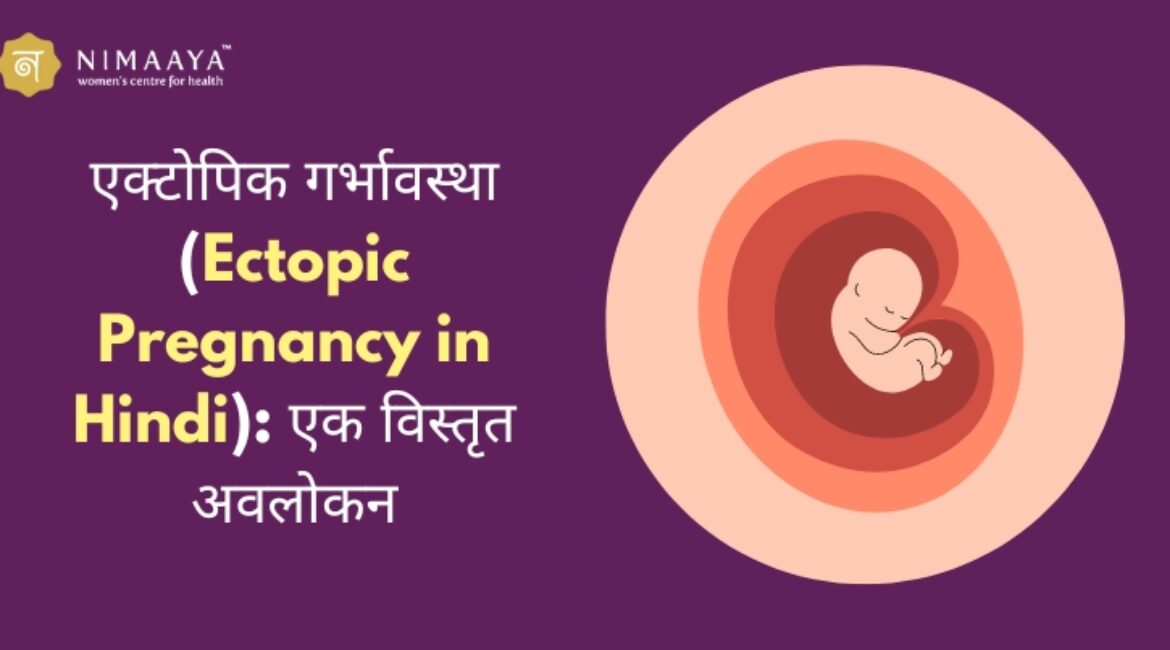 एक्टोपिक गर्भावस्था (Ectopic Pregnancy in Hindi): एक विस्तृत अवलोकन