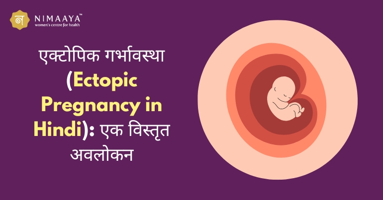 Ectopic Pregnancy in Hindi