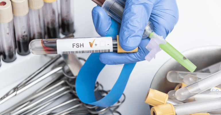 FSH blood test