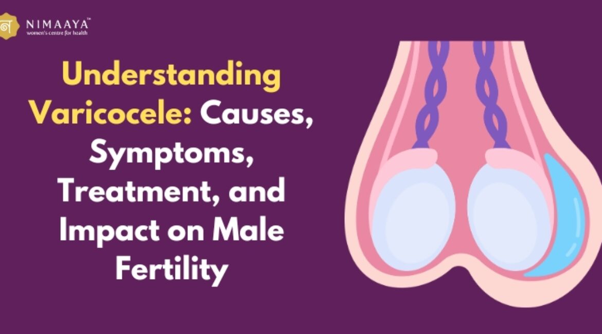 Understanding Varicocele: Causes, Symptoms, Treatment, and Impact on Male Fertility