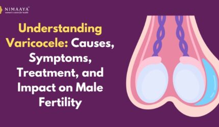 Understanding Varicocele: Causes, Symptoms, Treatment, and Impact on Male Fertility