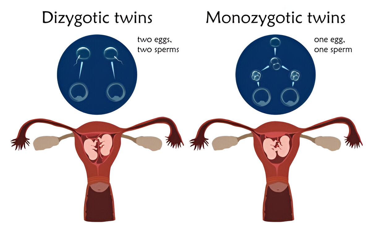 Types of Pregnancy 