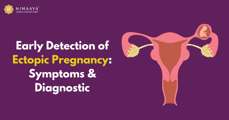 Ectopic Pregnancy