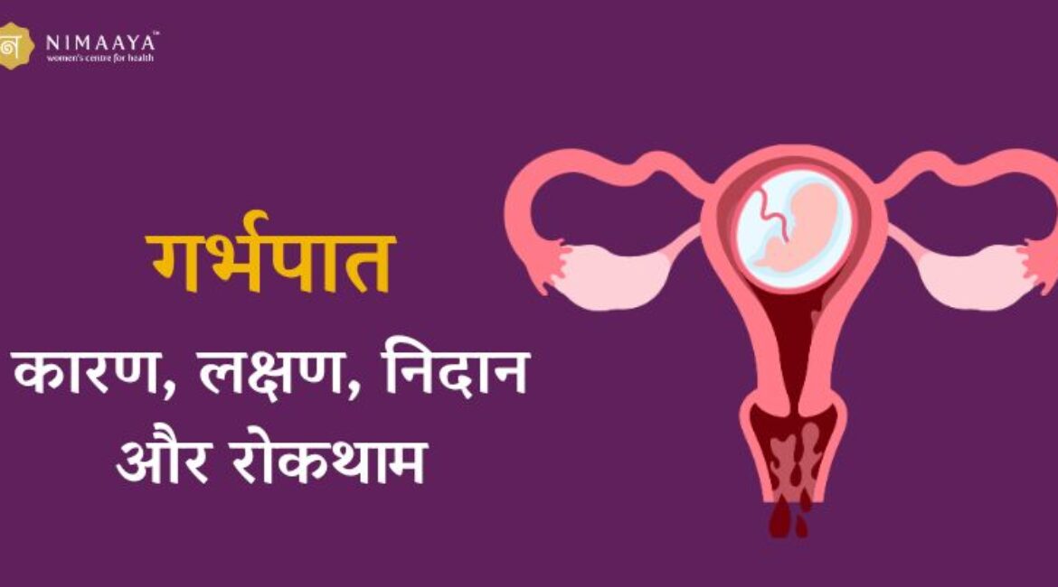 गर्भपात (Miscarriage): कारण, लक्षण, निदान, इलाज और रोकथाम की पूरी जानकारी