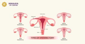 Types of Hysterectomy in Marathi