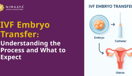 IVF Embryo Transfer: Understanding the Process and What to Expect